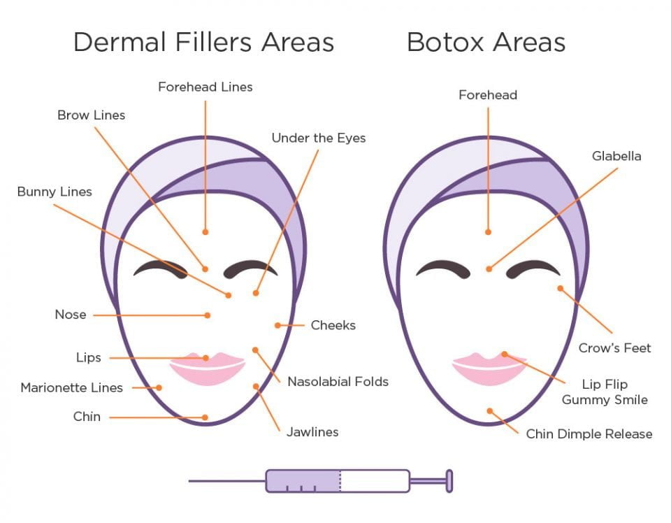 Botox Juvéderm Restylane Oh Meu Qual é O Injetável Certo Para Si Cirurgia Estética De