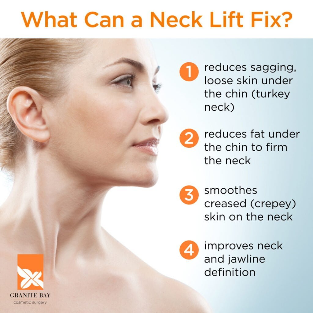 Granite Bay Cosmetic Surgery What Can a Necklift Do