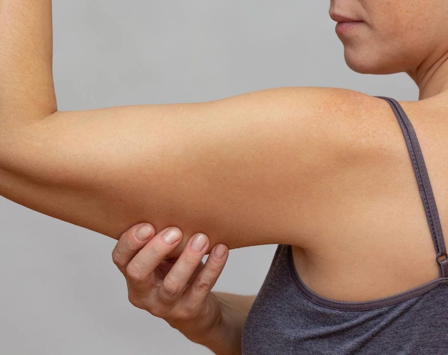 woman touching sagging skin on upper arm