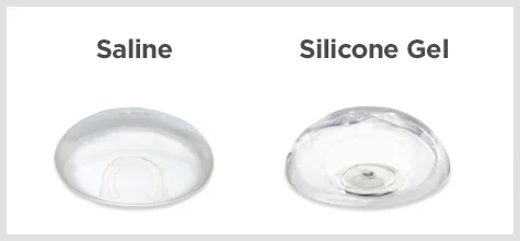 saline and silicone gel breast implant graphic
