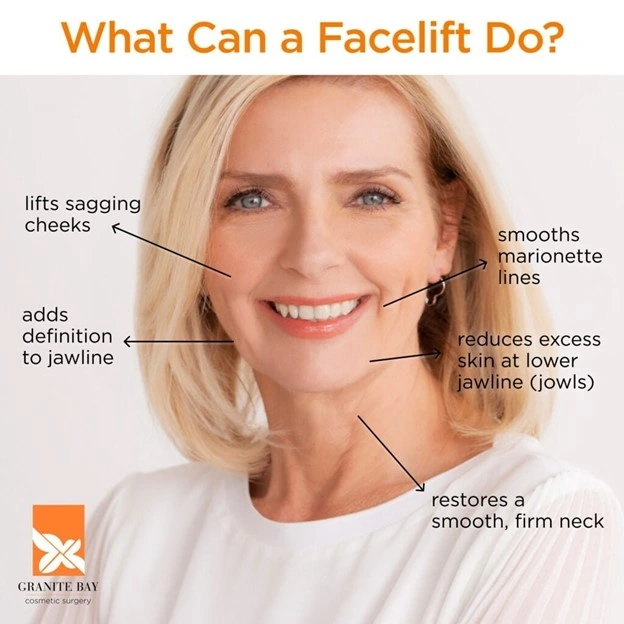 Facelift graphic