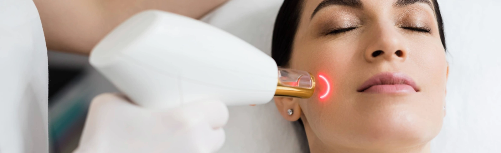 woman receiving laser treatment on face