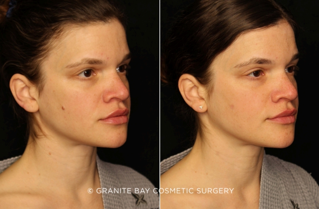 Case # 1 before photo