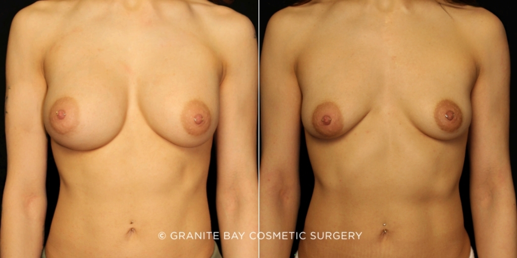 Case # 50 before photo