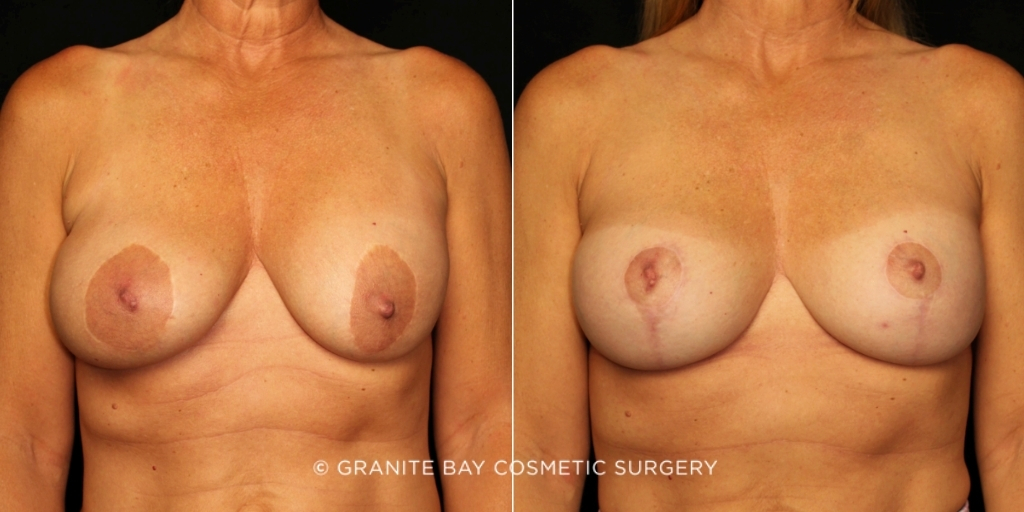 Case # 55 before photo