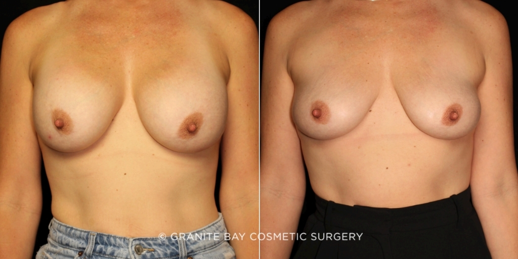 Case # 51 before photo