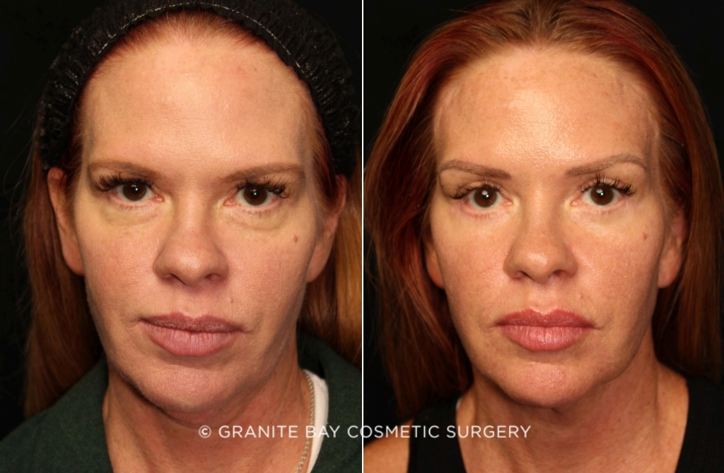 Case # 18 before photo