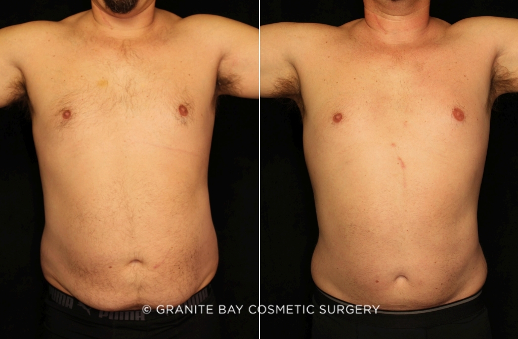 Case # 12 before photo