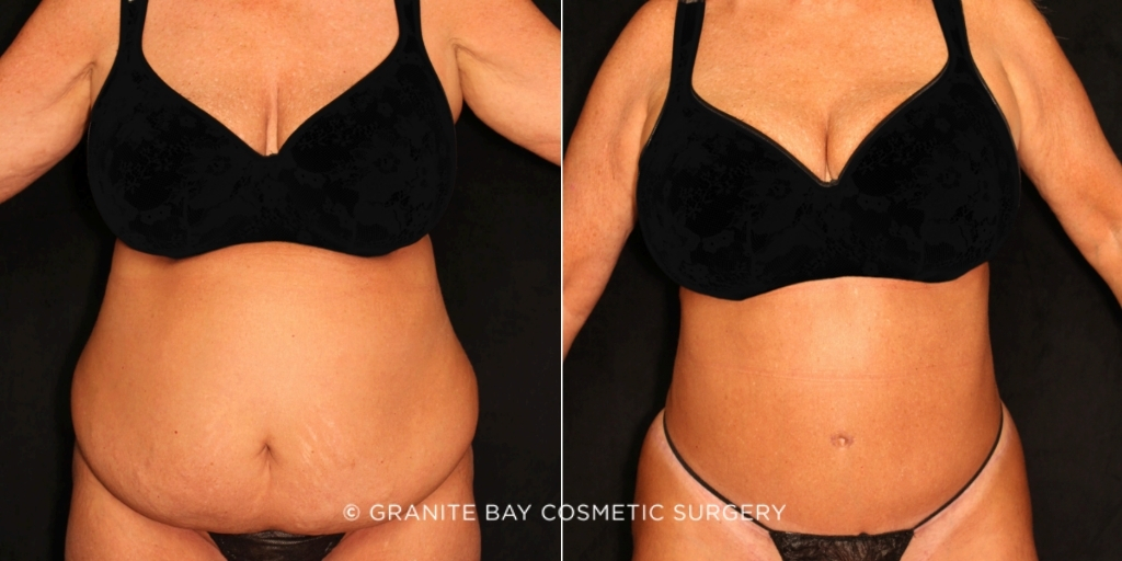 Case # 137 before photo