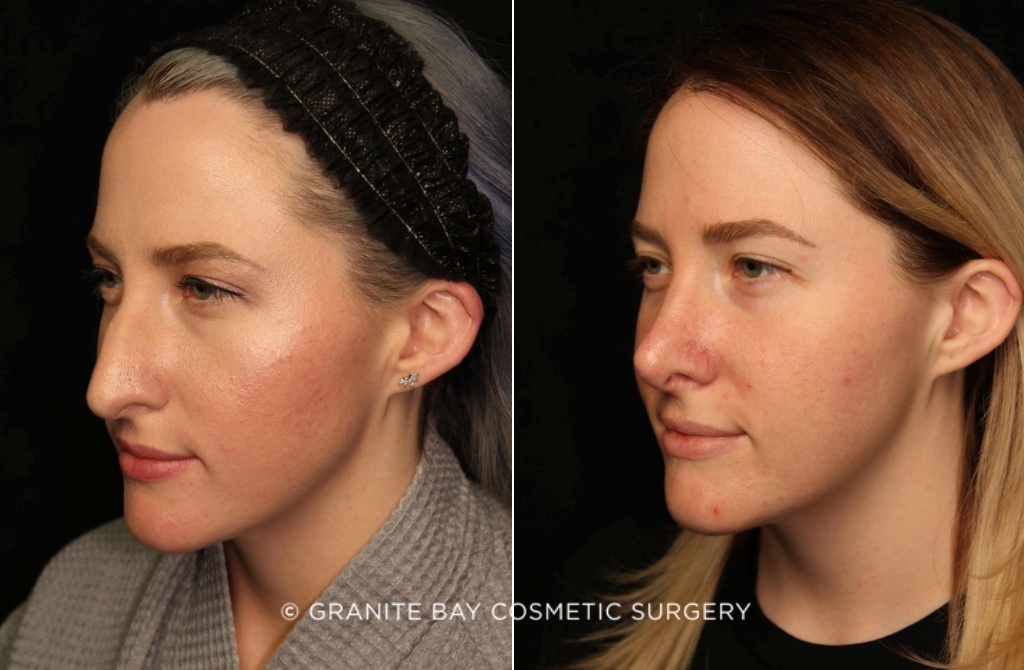 Case # 1 before photo