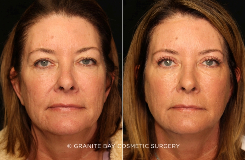 Case # 19 before photo