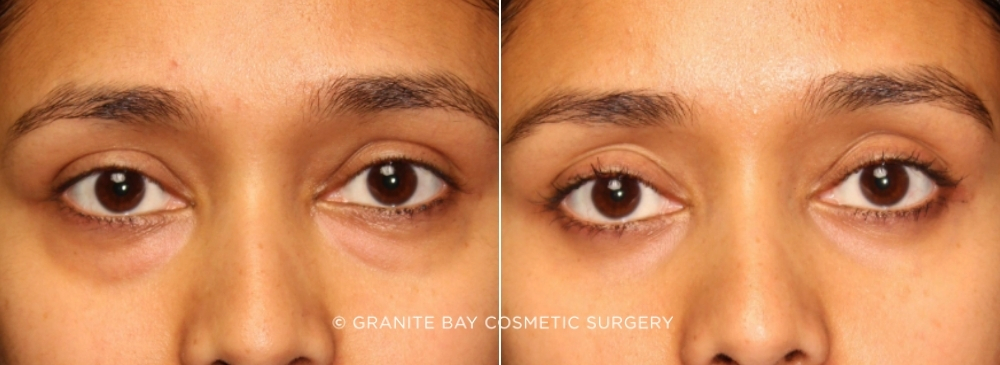 Case # 20 before photo