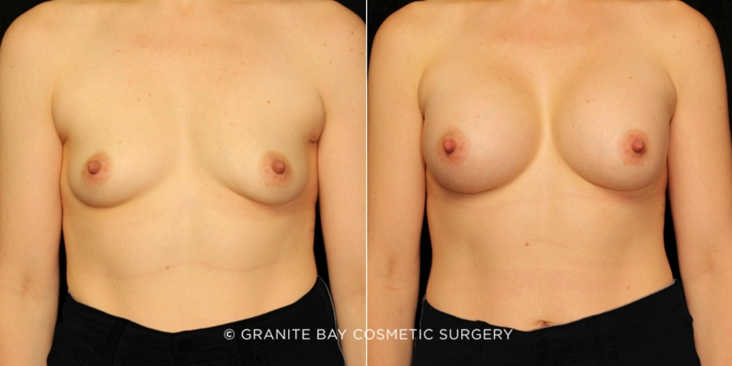 Case # 176 before photo