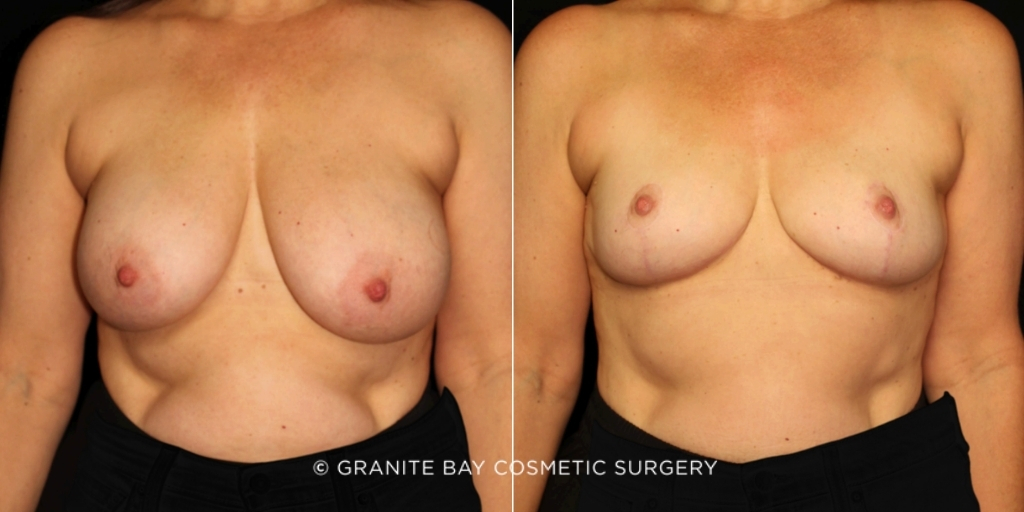 Case # 45 before photo