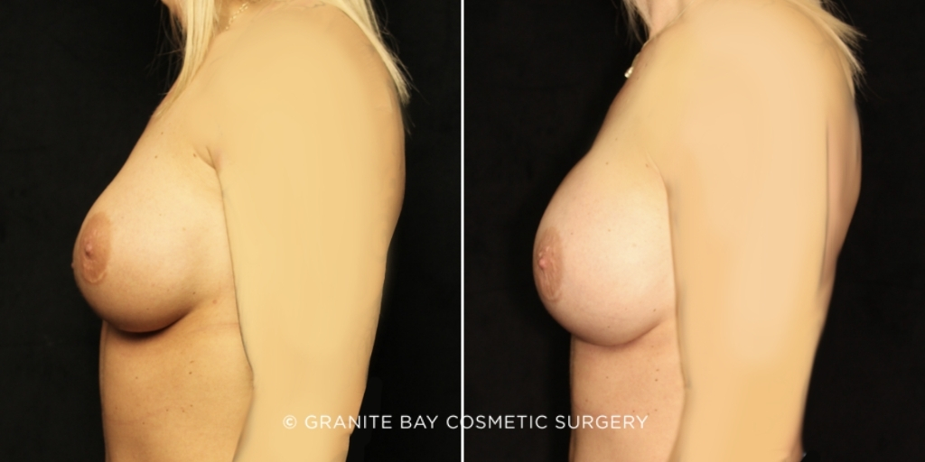  bna image b