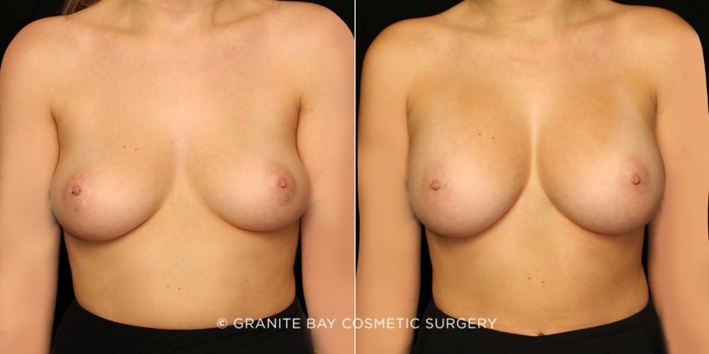 Case # 169 before photo