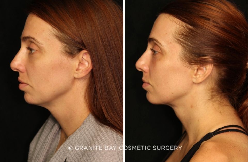 Case # 1 before photo