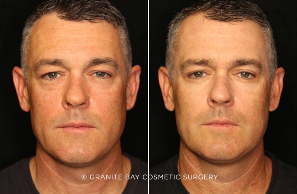 Case # 8 before photo