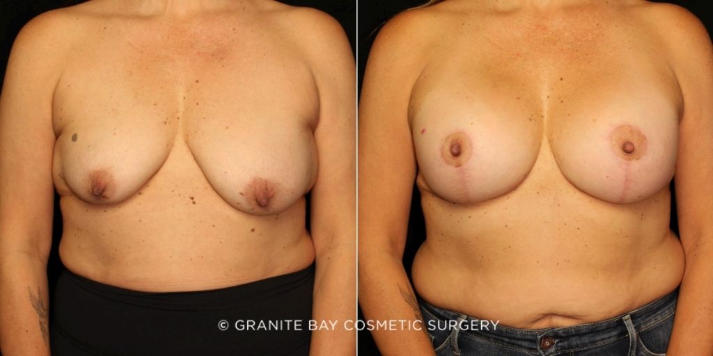 Case # 54 before photo