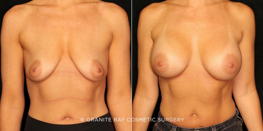 Case # 170 before photo