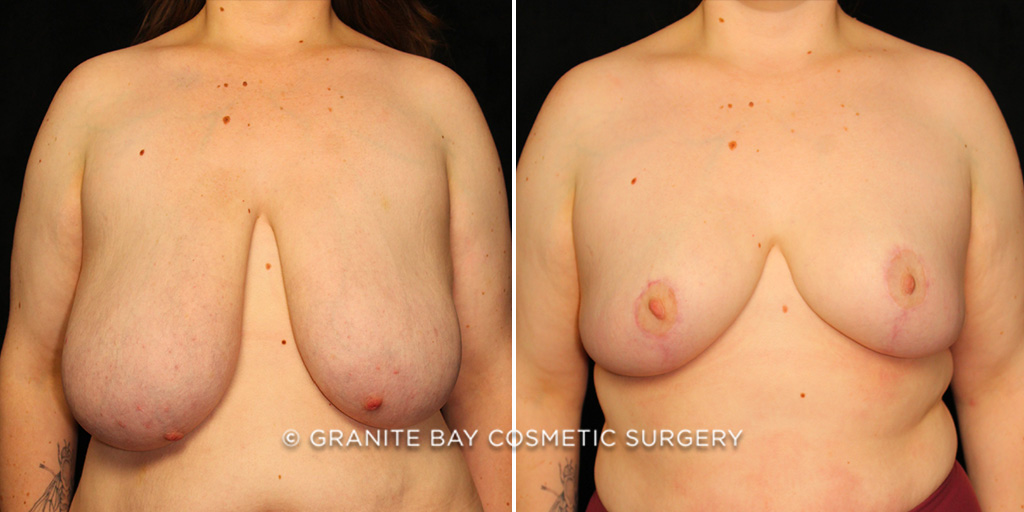 Case # 46 before photo