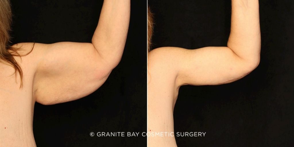 Case # 19 before photo