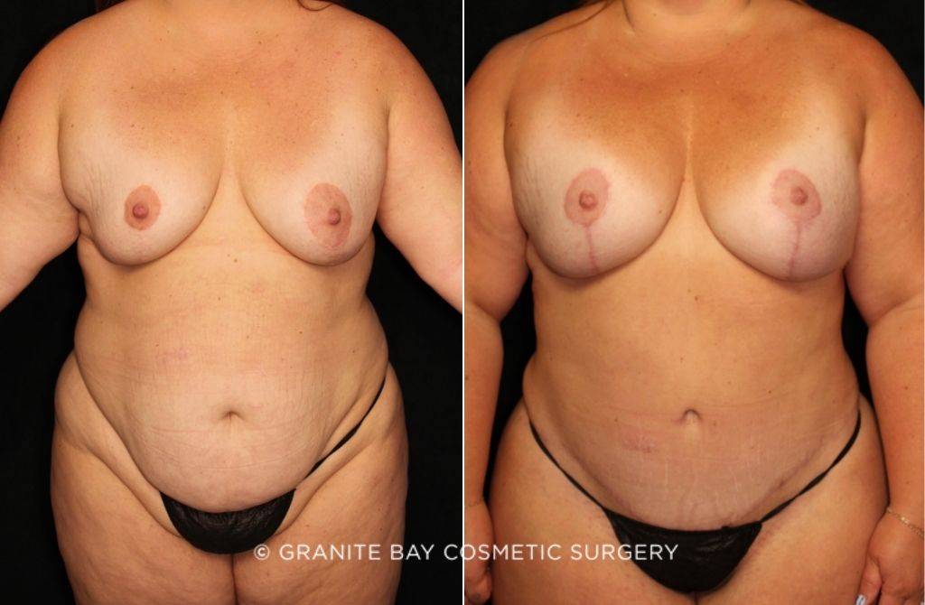 Case # 75 before photo