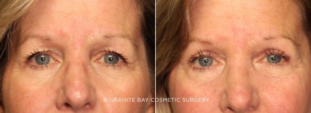 Case # 10 before photo