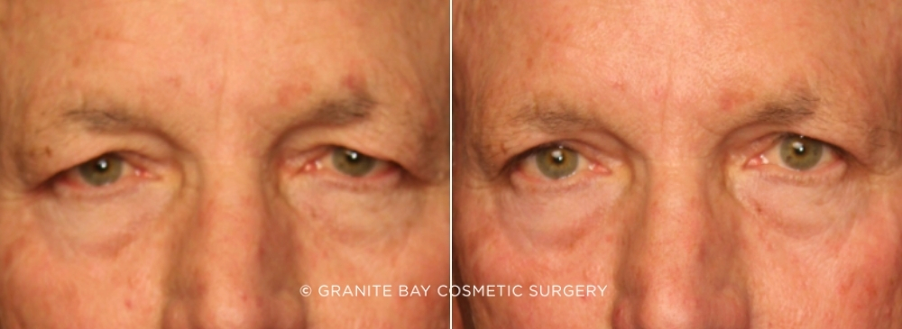 Case # 13 before photo