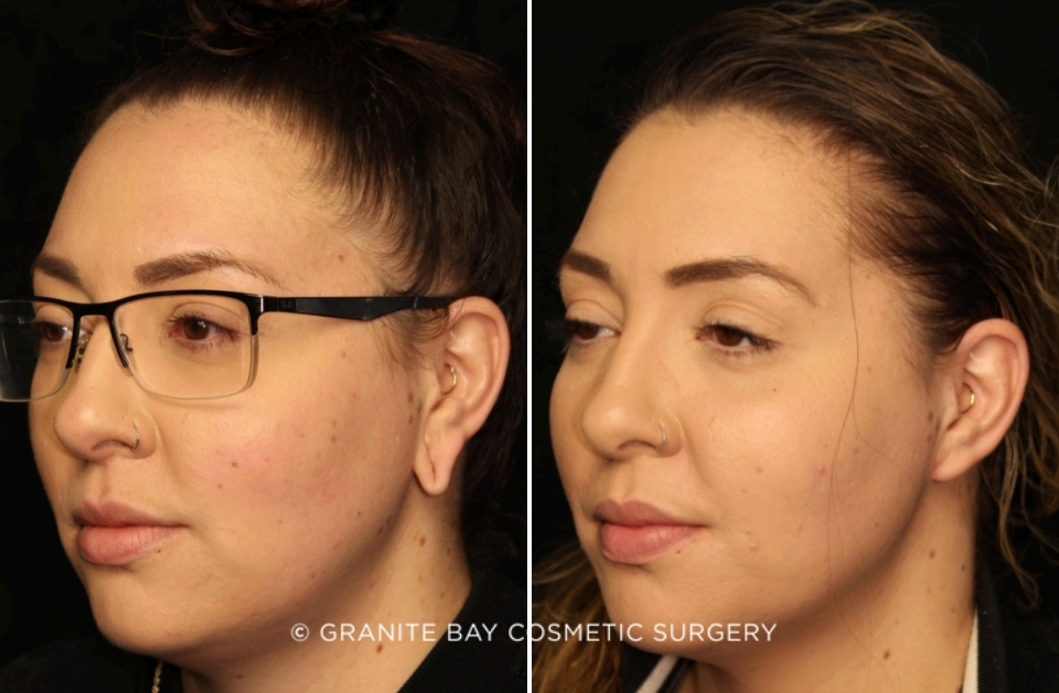 Case # 1 before photo