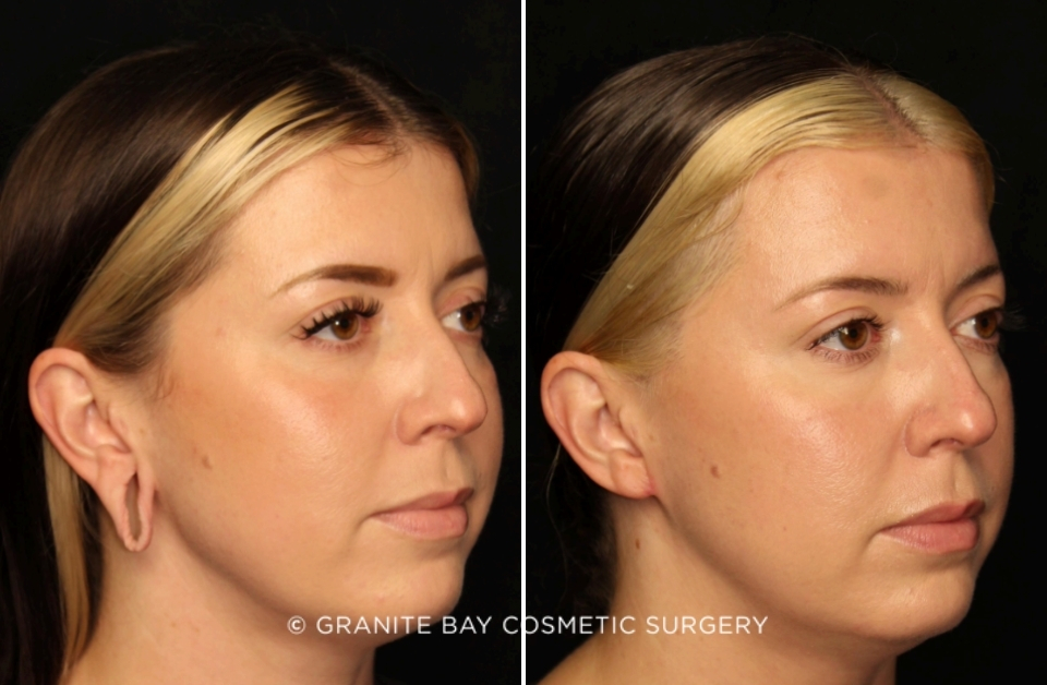 Case # 2 before photo