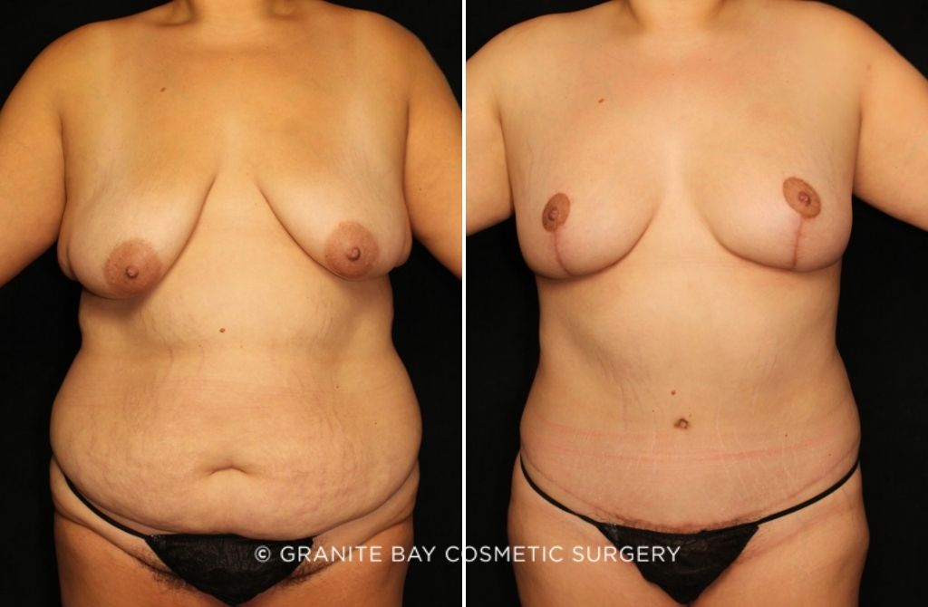 Case # 139 before photo