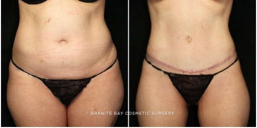 Case # 26 after photo
