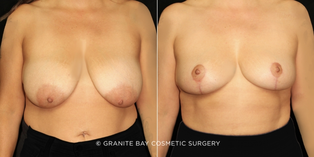 Case # 29 before photo