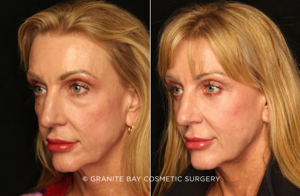 Case # 21 before photo