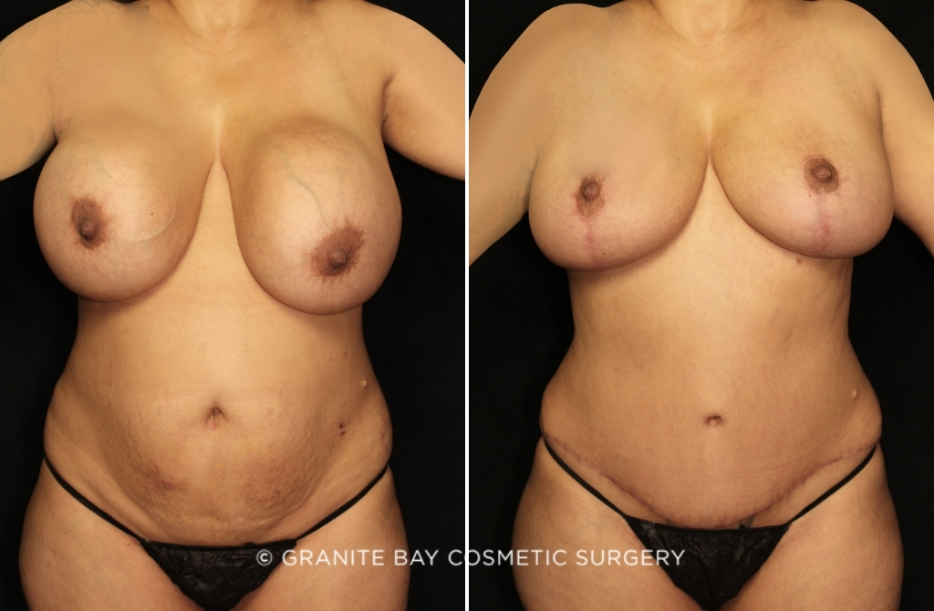 Case # 77 before photo