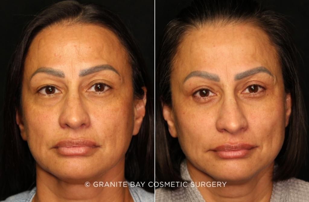 Case # 22 before photo