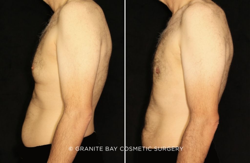  bna image b