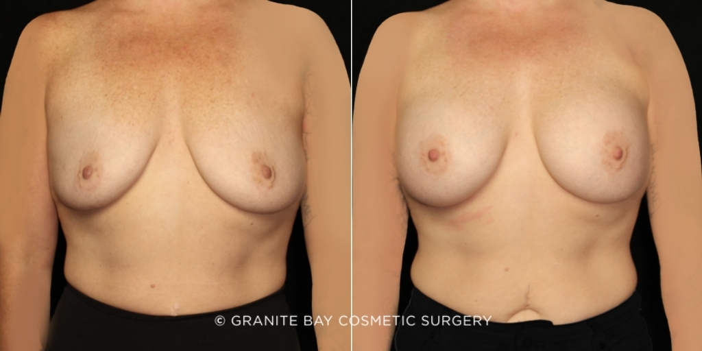 Case # 177 before photo