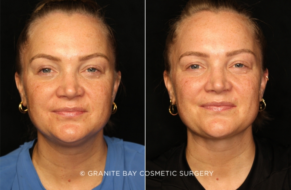 Case # 2 before photo