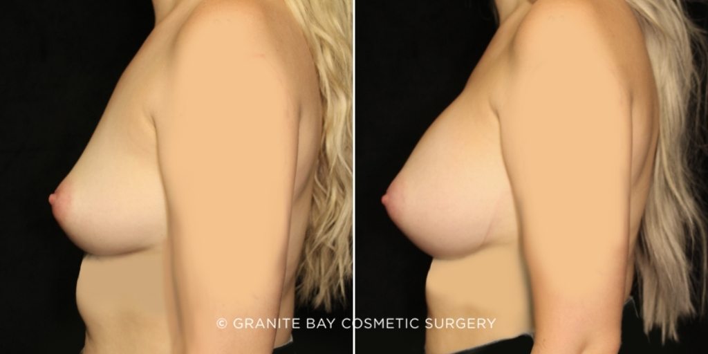  bna image b