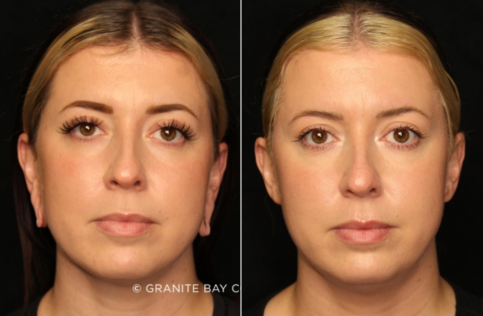 Case # 2 before photo