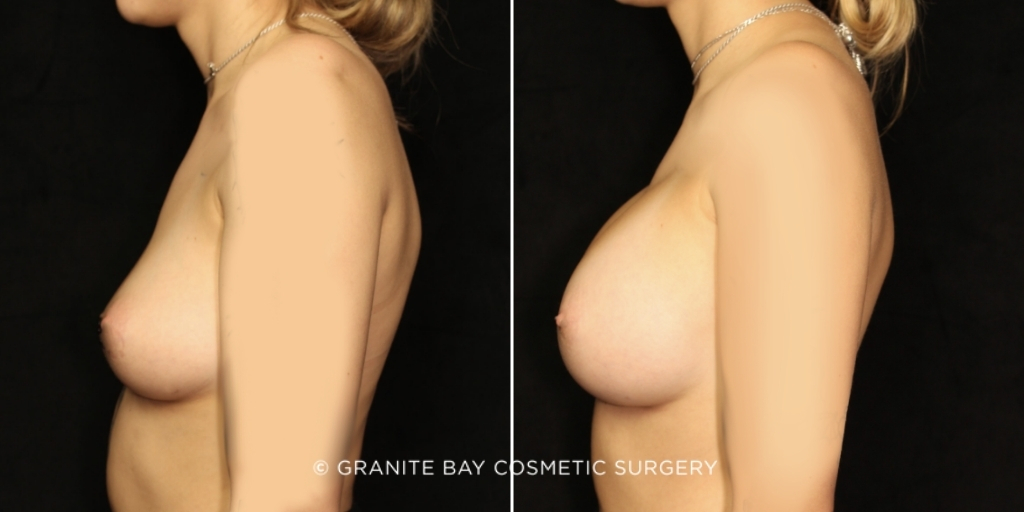  bna image b