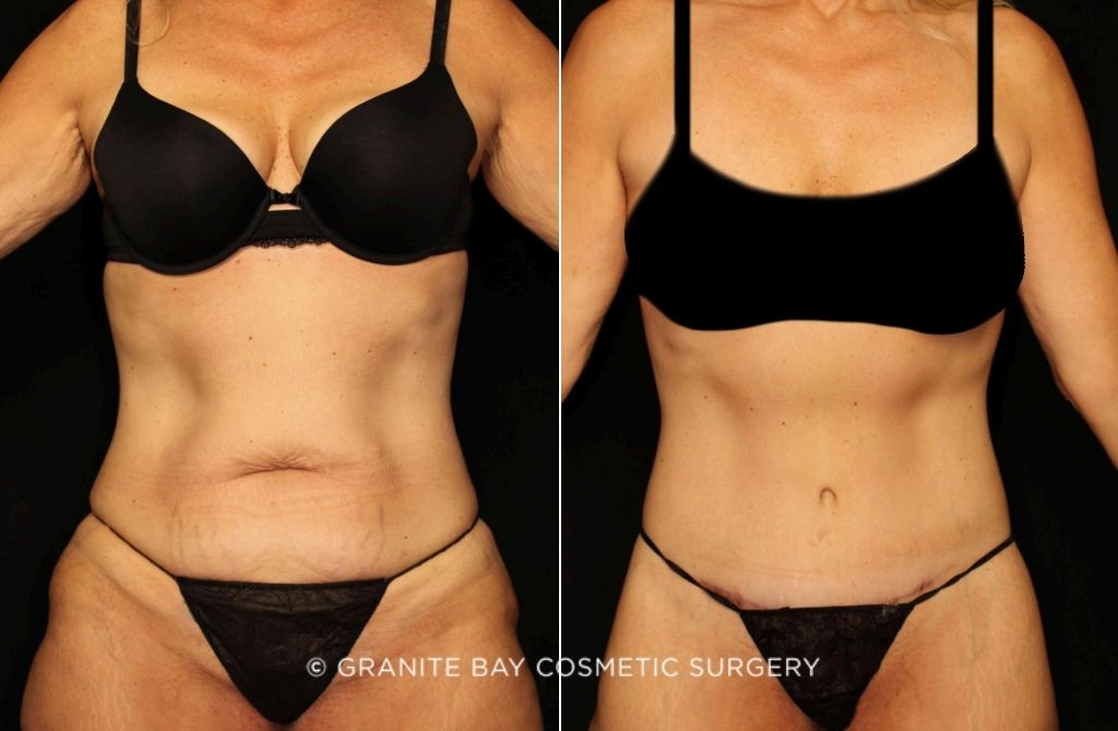 Case # 1 after photo