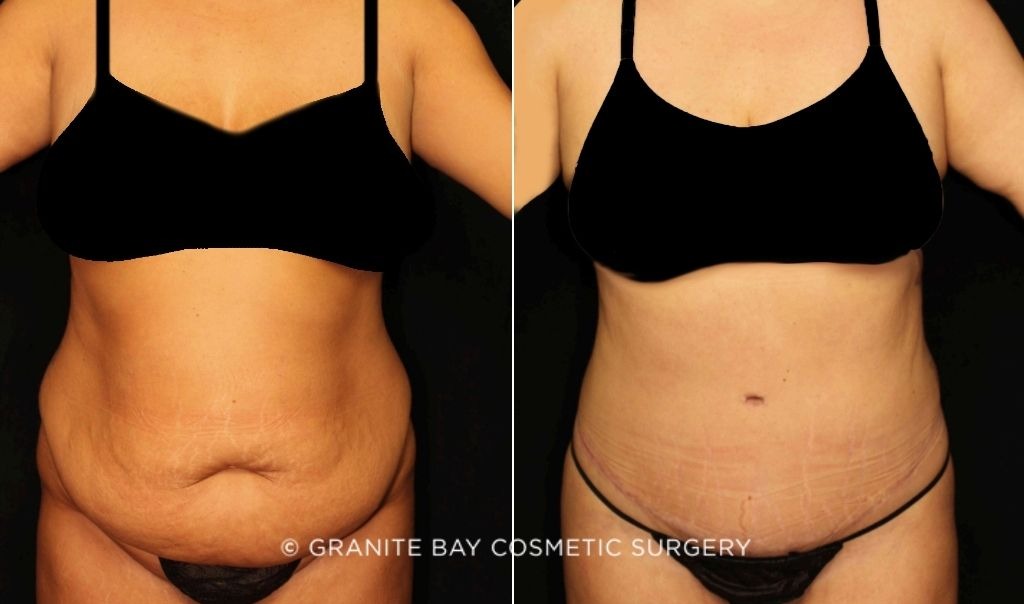 Case # 1 after photo