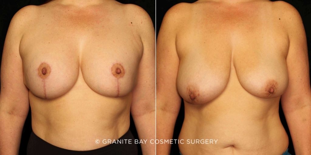 Case # 1 after photo