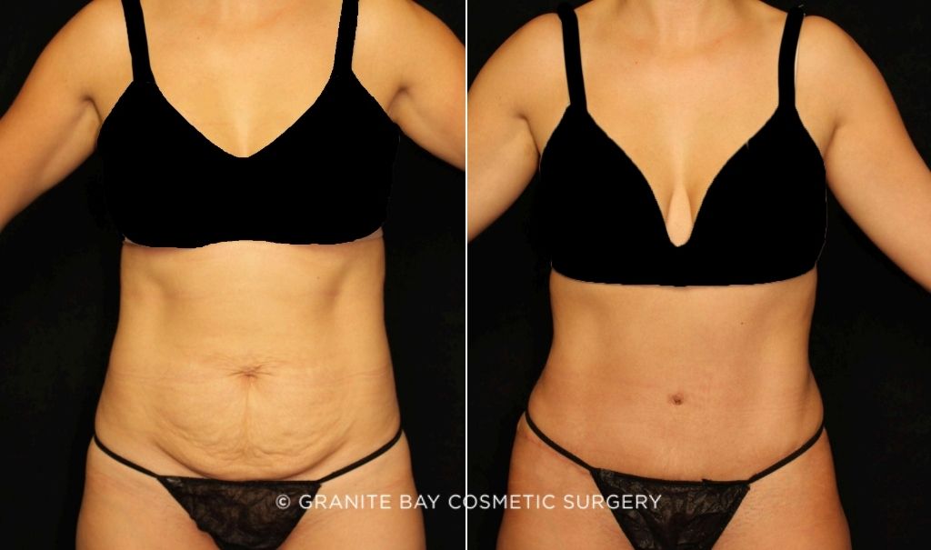 Case # 3 after photo