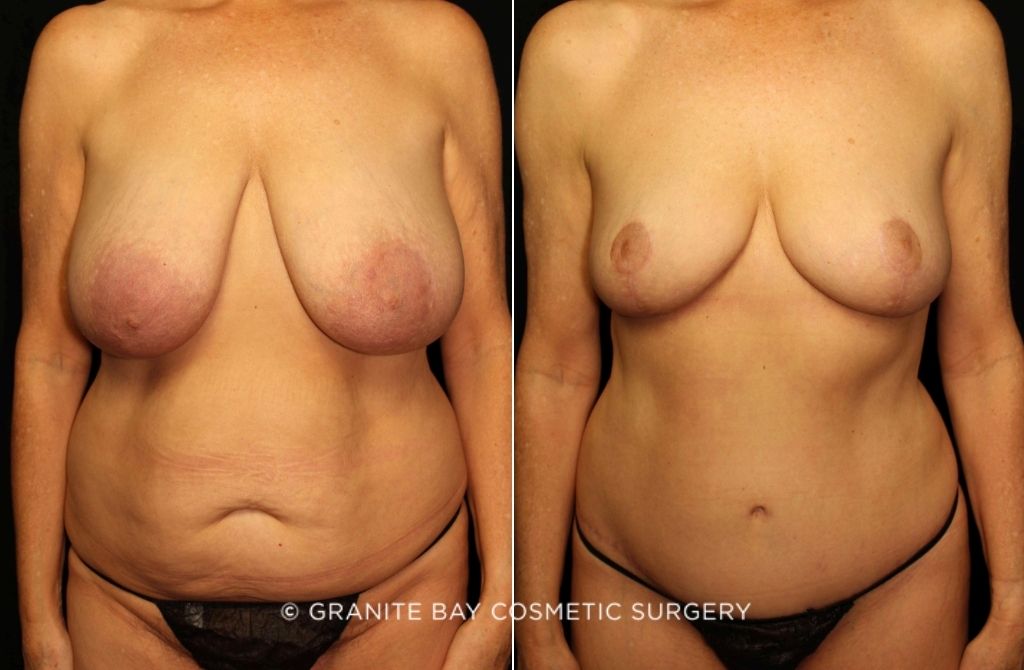 Case # 3 after photo