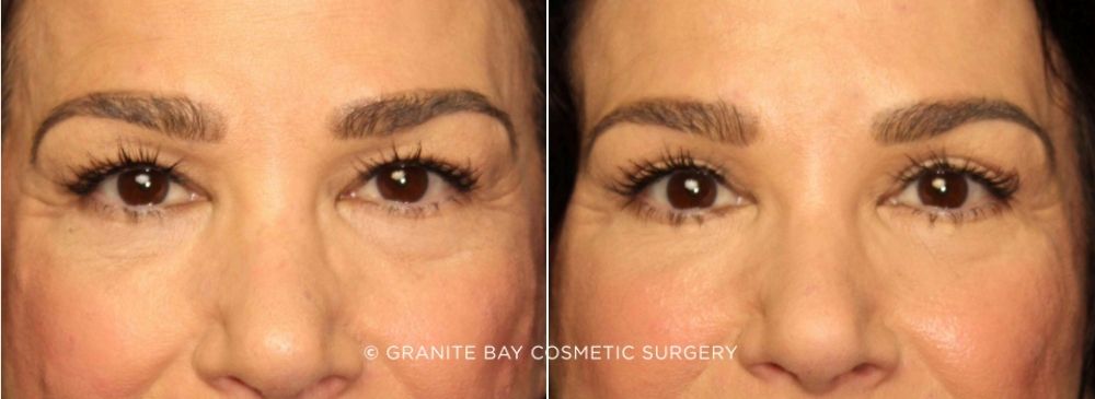 Case # 4 after photo