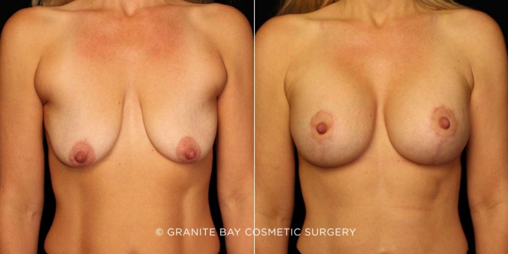 Case # 2 after photo